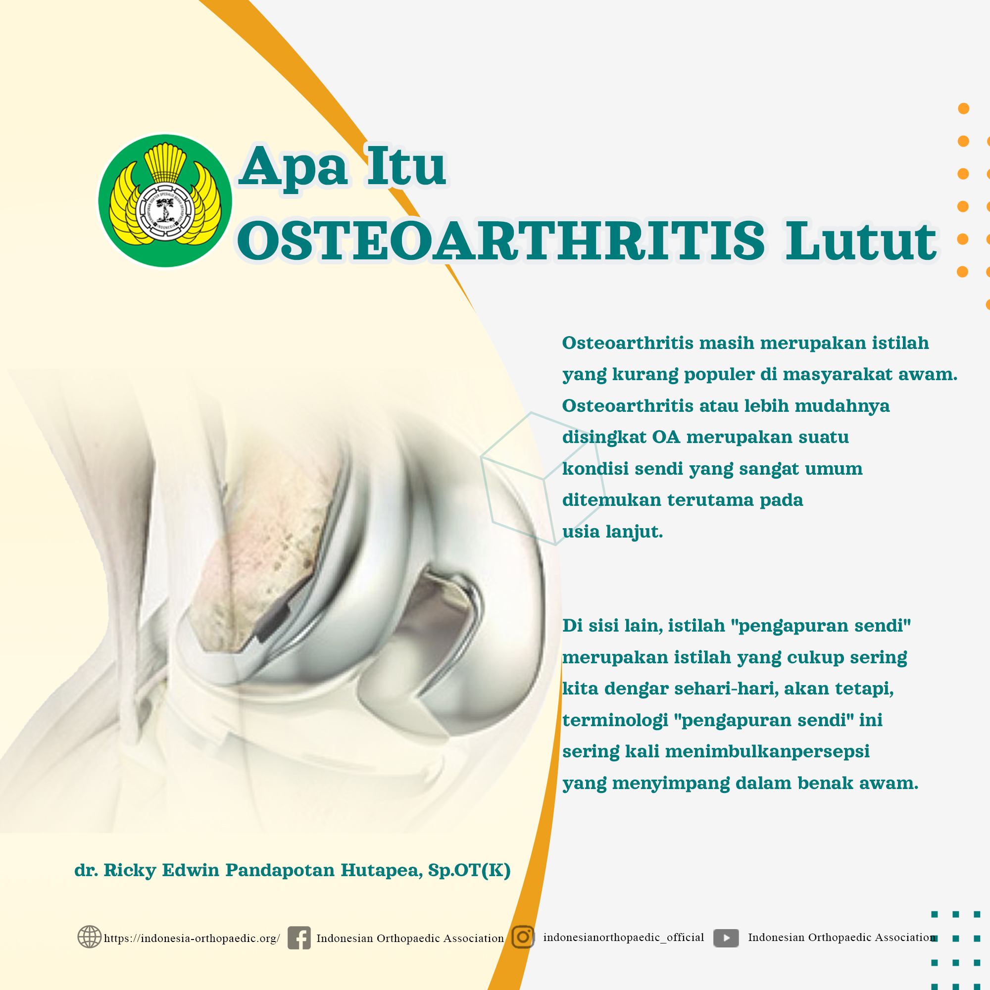 Osteoarthritis adalah